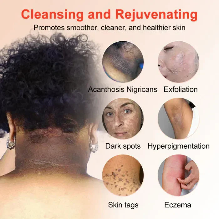 🔥Orange Enzyme Exfoliating Gel — The Gentle Miracle Your Skin Has Been Crying Out For