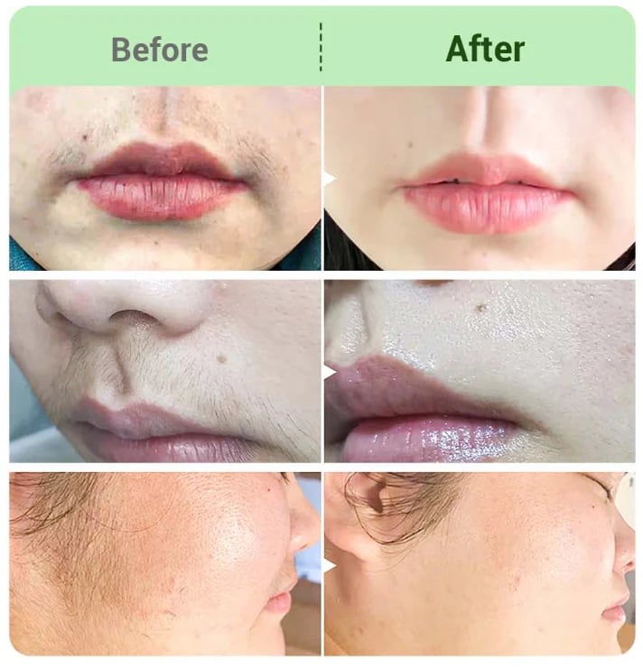 🌎Ends Today: 70% OFF!     Hair Removal Cream for All Women & Men