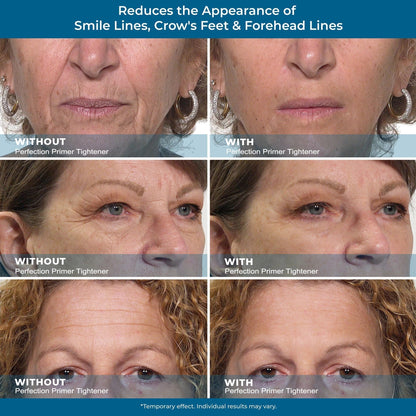 Instant Eye Firming Serum - Instantly Visibly Reduces Under-Eye Bags, Wrinkles, Dark Circles, Fine Lines, and Crow's Feet. Anti-Aging and Anti-Wrinkle Treatment for Full Face Size Tube.