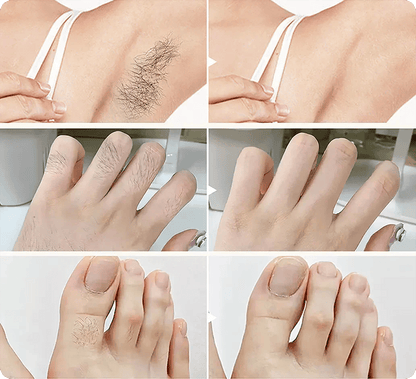 🥥 Painless Hair Removal — Face, Underarms, Legs, & Intimate Areas — Gentle Growth Inhibition: Coconut Hair Removal Cream