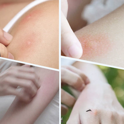 🔥🛡️ 2026 Upgraded Ultrasonic Mosquito Repellent Bracelet - Powerful & Non-Toxic
